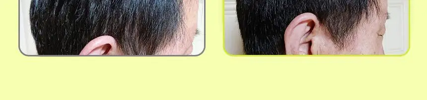[카이스트특허기술] 그래비티 헤어리프팅 샴푸 엑스트라스트롱 475ml 2입 기획 상세페이지 7